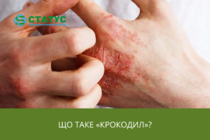 Що таке Крокодил