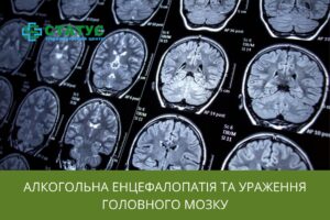 Алкогольна енцефалопатія та ураження головного мозку